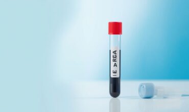Prostat Spesifik Antijen (PSA Total) Nedir, Kaç Olmalı?