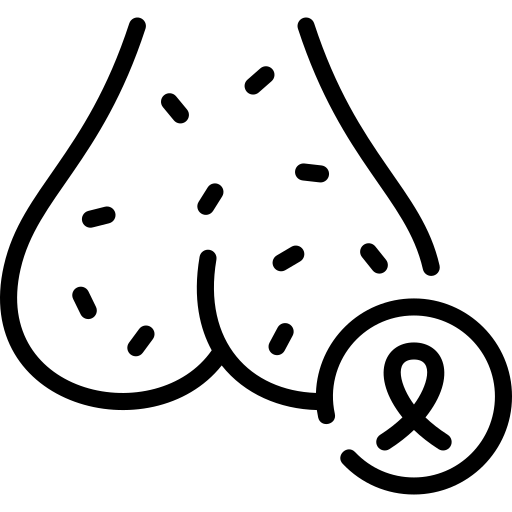 Varikosel